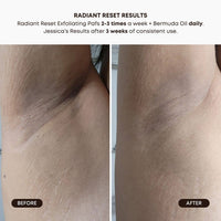 Thumbnail for Radiant Reset Exfoliating Toner Pads